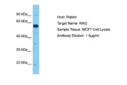 RAI2 Rabbit anti-Human, Polyclonal, Novus Biologicals 0.1 mL | Buy Online | Novus Biologicals | Fisher Scientific